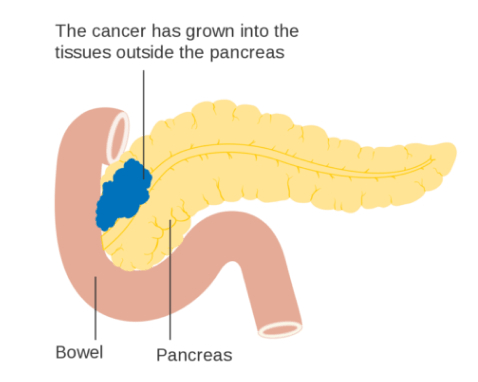 cancer-free-mumbai-img