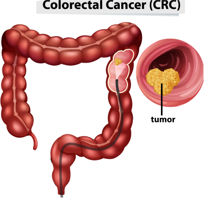 cancer-free-mumbai-img