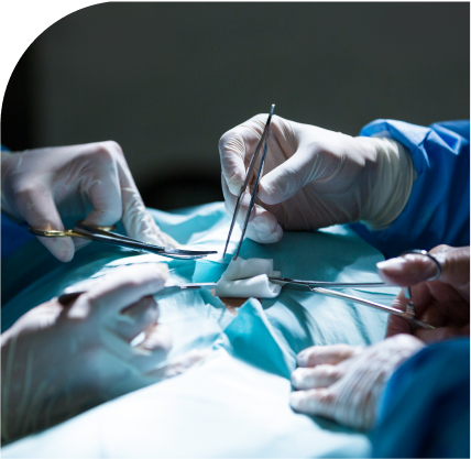 before-operation-img