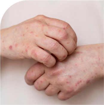 cancer-free-mumbai-img